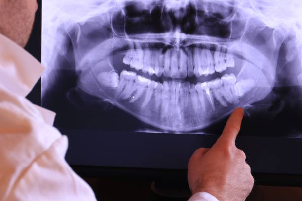 Urgent Tooth Repair in MO